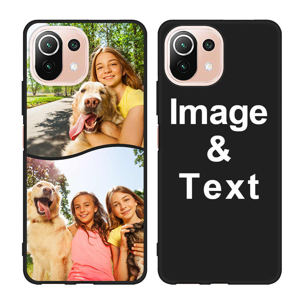 Custom for Xiaomi 11 Lite 5G NE Candy Case
